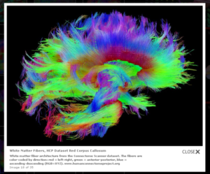 neuroimagen 2